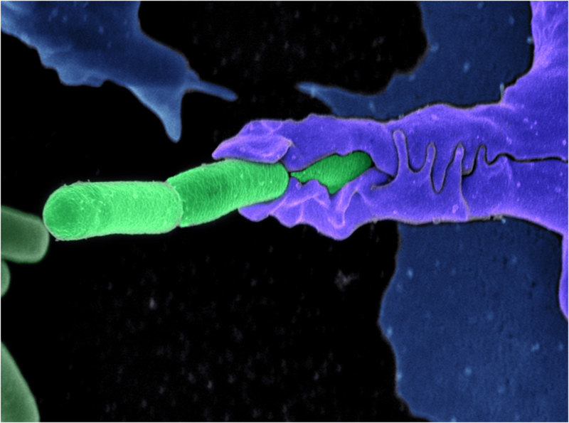 Illustration for article titled The Astounding And Horrific World As Seen Under A Microscope